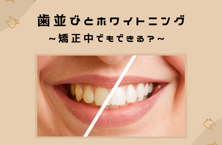 ホワイトニングと歯並びの関係性 ~矯正中でもできるの？~